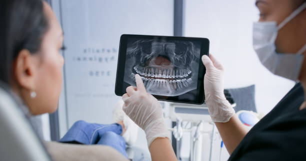 Licensed Tooth Extraction service in Menlo Park, CA - Smile Center Dentistry